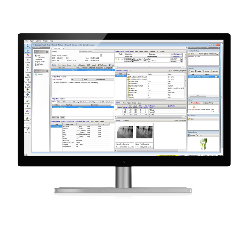 Henry Schein Inc. Monitor Biological In Office Maxitest Starter